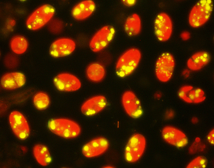 Figure 2.  Algae containing lipids. Lipids appear as globular spheres within the cells. (These lipids appear yellow in the photo; when printed in black-and-white, they appear white.) (Photo courtesy: Dr. Ann Wilkie, University of Florida-IFAS)